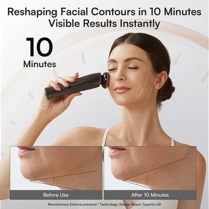 INIA FLARE™ 6-in-1 Facial Beauty & Skin Rejuvenation Device
